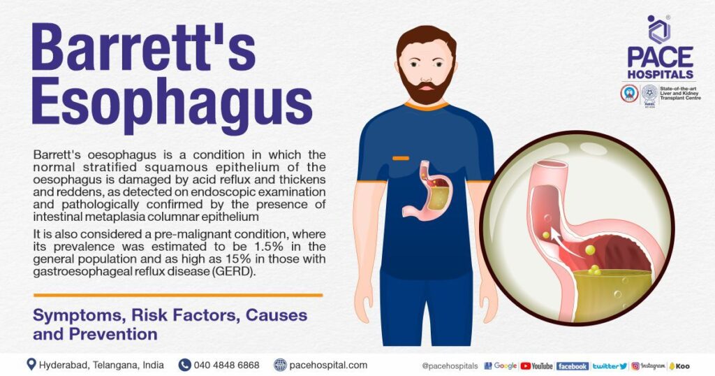 What is Barrett’s Esophagus Understanding the Condition and Its